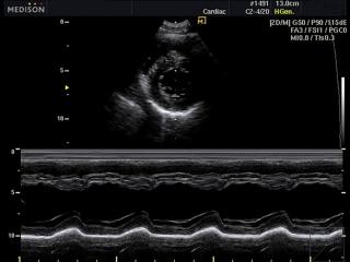 Heart - left ventricle, M-mode