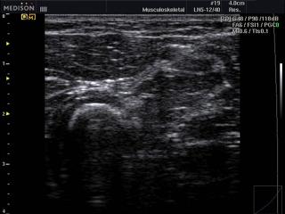 Soft tissue, Quick-FSI