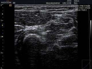 Soft tissue, B-mode