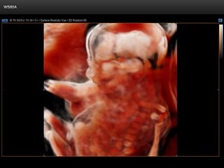 Fetus - 21 weeks, Realistic Vue 3D