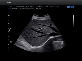 Liver, S-Harmonic