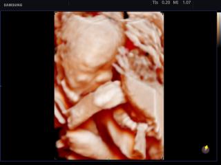 Fetus, Realistic Vue, 3D