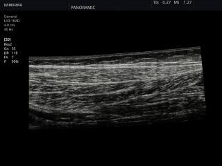 Gastrocnemius muscle, B-mode