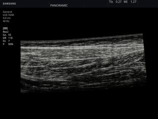 Gastrocnemius muscle, B-mode