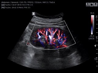 Kidney, S-Flow