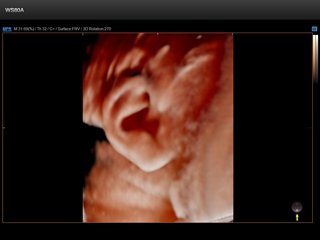 Fetal ear, Realistic Vue, 3D