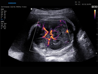 Circle of Willis, MV-Flow + LumiFlow