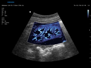 Kidney, MV-Flow