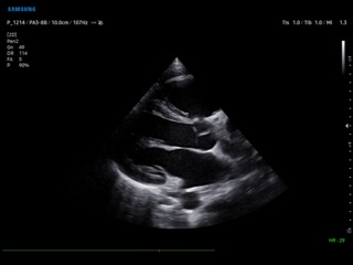 Pediatric echocardiography