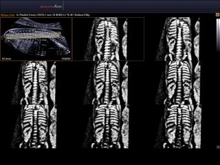 Accuvix A30: Скелет плода, Multi OVIX и 3D