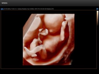 WS80A-RUS: Плод - 14 недель, Realistic Vue 3D