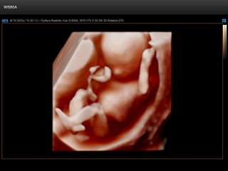 Плод - 14 недель, Realistic Vue 3D